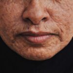 手麻腳麻是警訊嗎？神經外科醫師解析脊椎壓迫與辨識方式